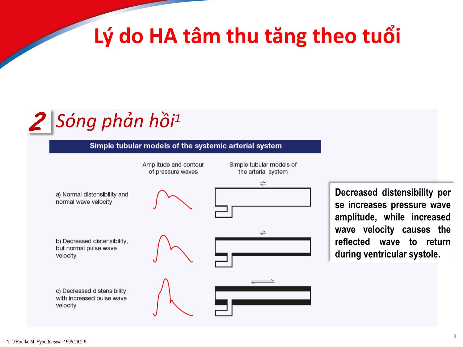 Bài giảng Chiến lược ngăn ngừa đột quỵ ở bệnh nhân tha trên 60 tuổi? trang 6