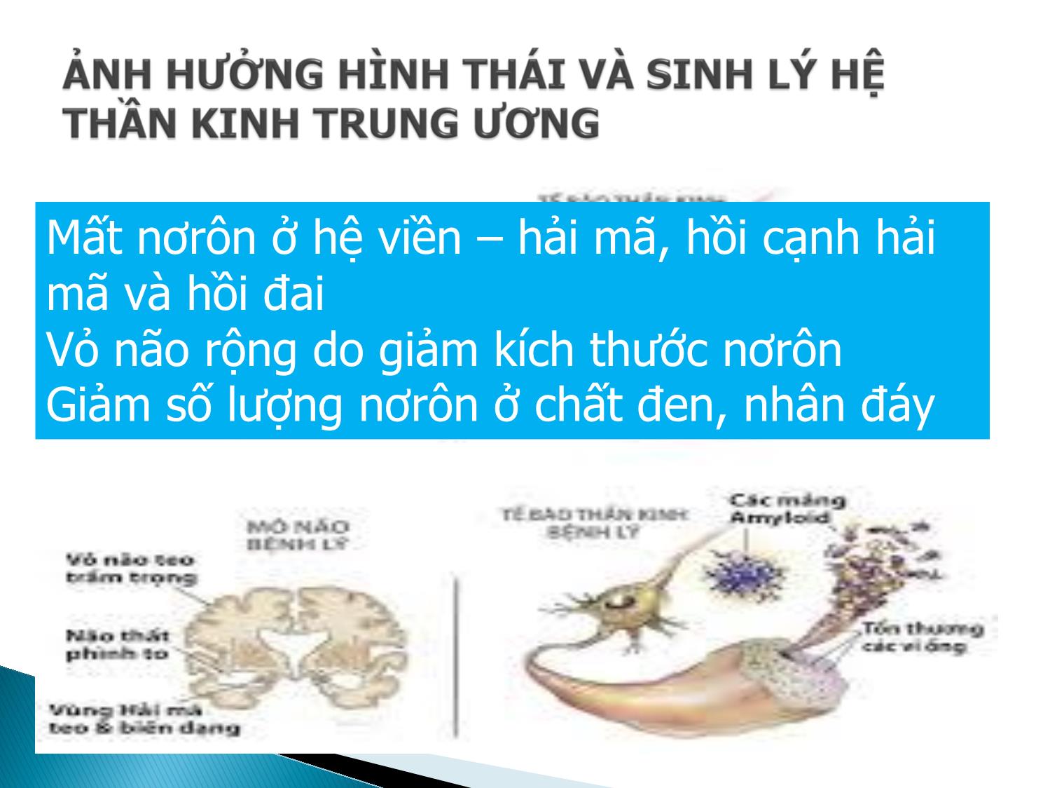 Bài giảng Lão hóa hệ thần kinh trang 4