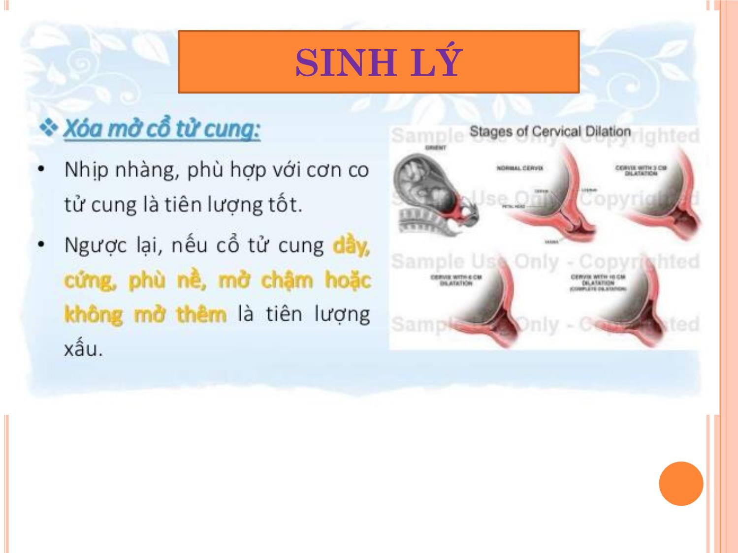 Bài giảng Dọa vỡ - Vỡ tử cung trang 2