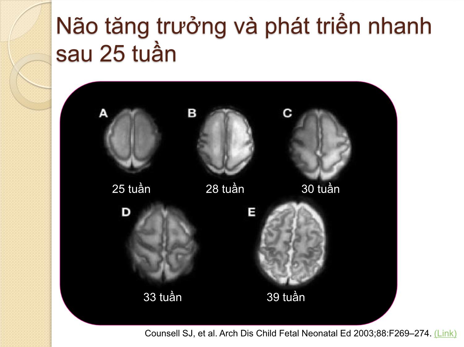 Bài giảng Khuyến cáo các can thiệp sản khoa để cải thiện kết cục trẻ sinh non trang 10