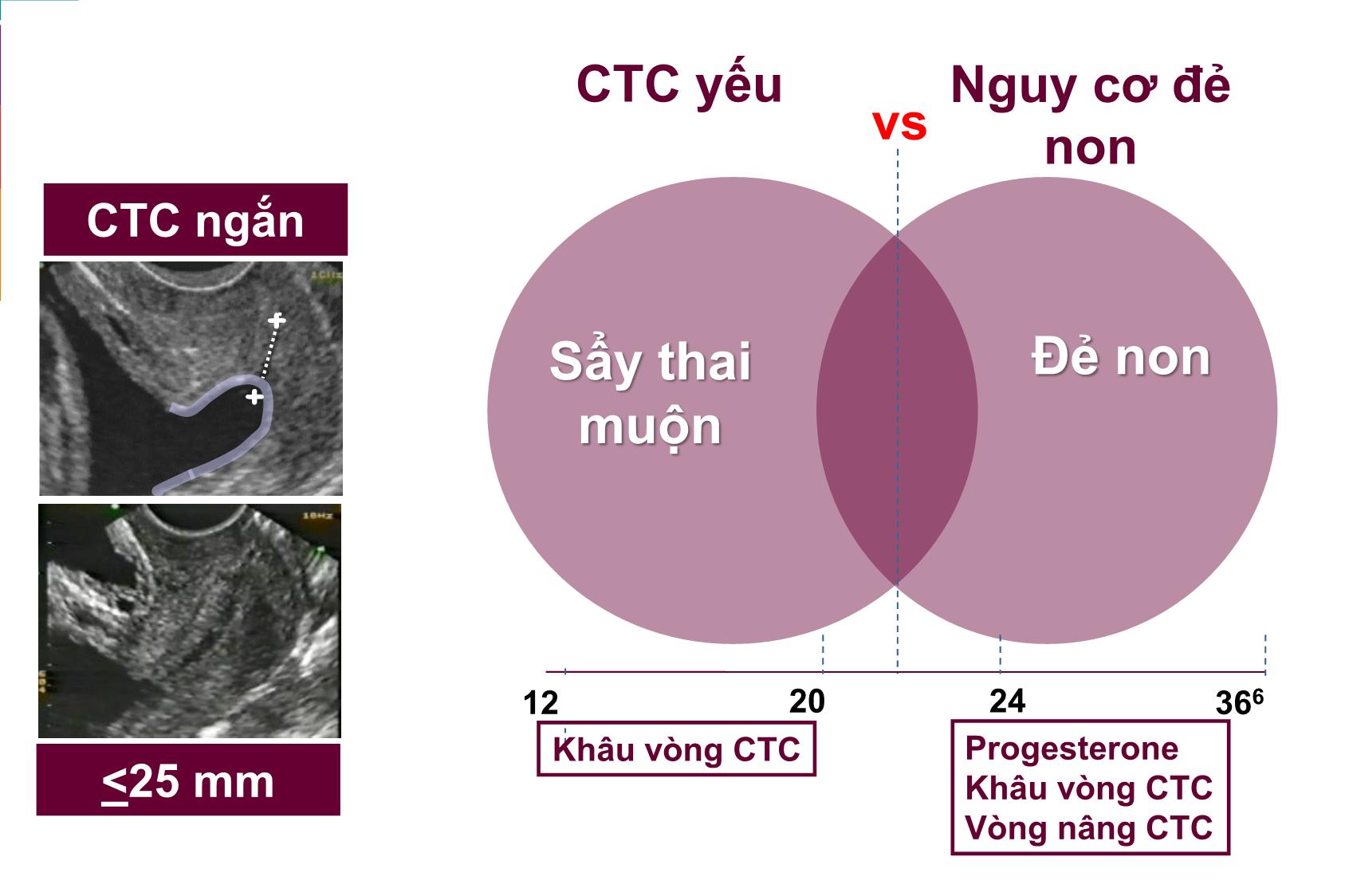 Bài giảng Progesterone, khâu vòng CTC và vòng nâng CTC trang 4