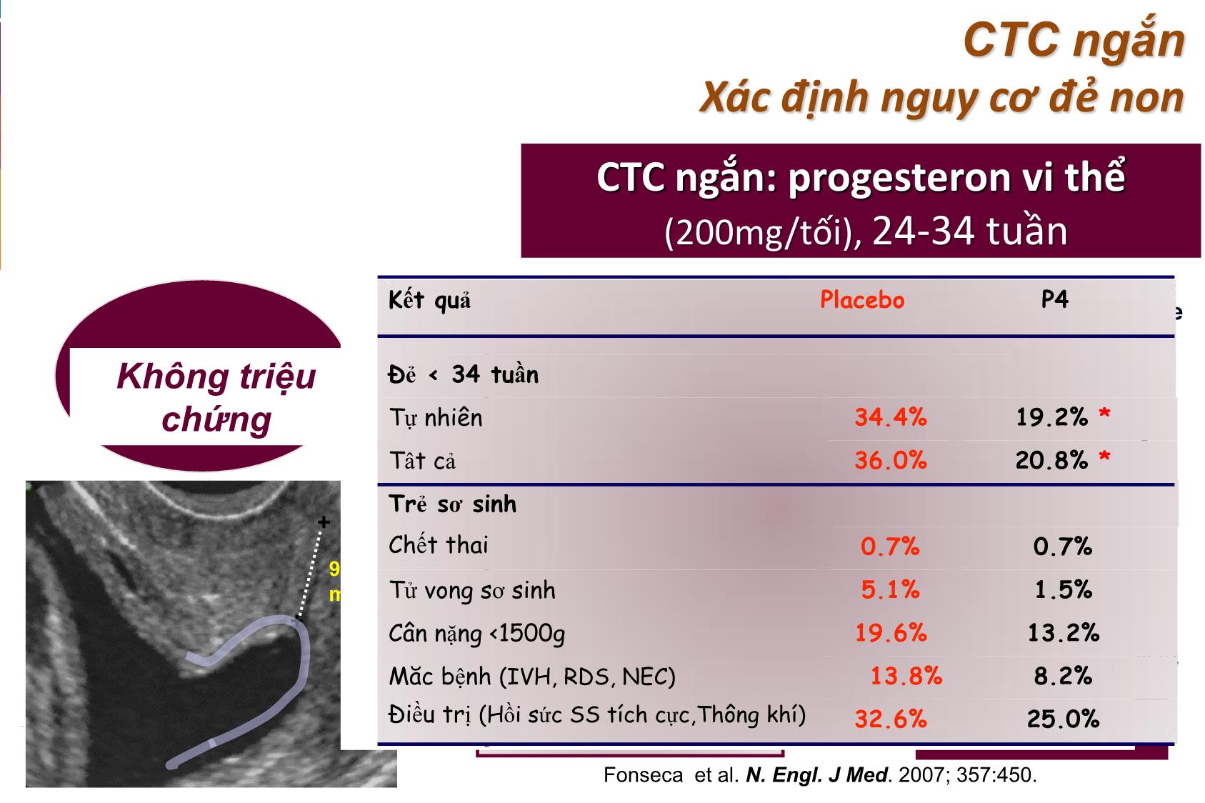 Bài giảng Progesterone, khâu vòng CTC và vòng nâng CTC trang 7