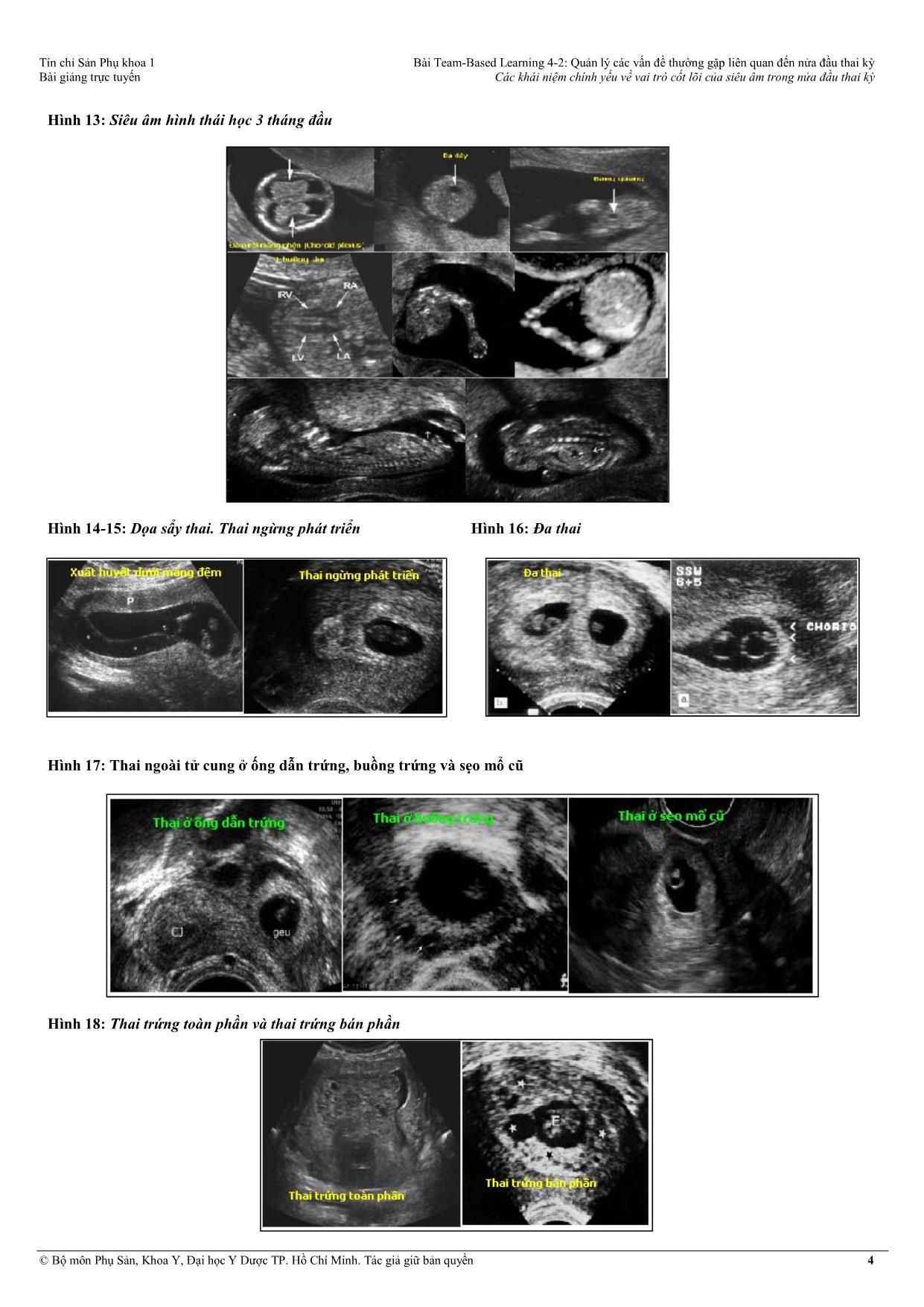 Tài liệu Team, based - Learning 4-2: Quản lý các vấn đề thường gặp liên quan đến nửa đầu thai kỳ - Các khái niệm chính yếu về vai trò cốt lõi của siêu âm trong nửa đầu thai kỳ trang 4