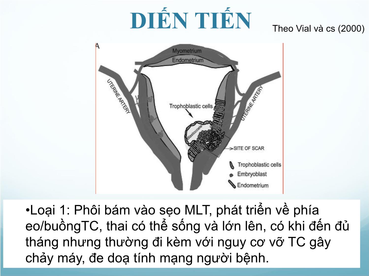 Bài giảng Thai bám ở sẹo mổ lấy thai trang 8