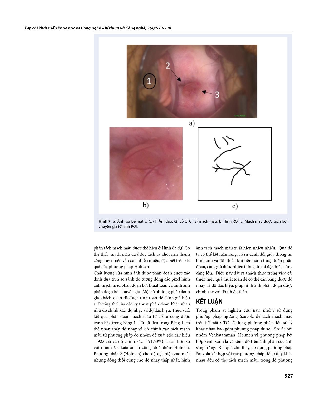 Phân đoạn mạch máu trên bề mặt cổ tử cung sử dụng hình ảnh phân cực và ngưỡng Sauvola trang 5