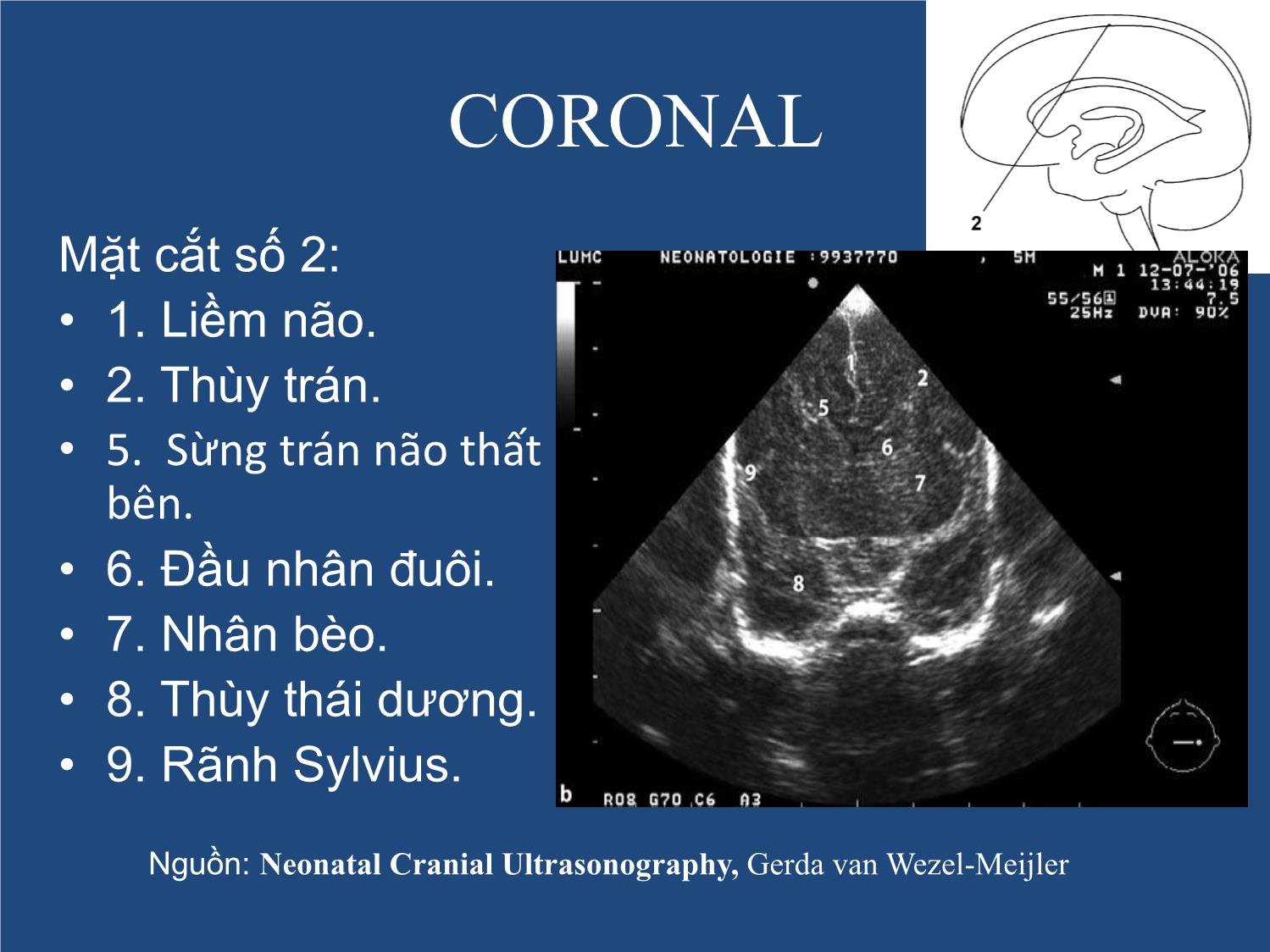 Bài giảng Neonatal Brain US trang 10