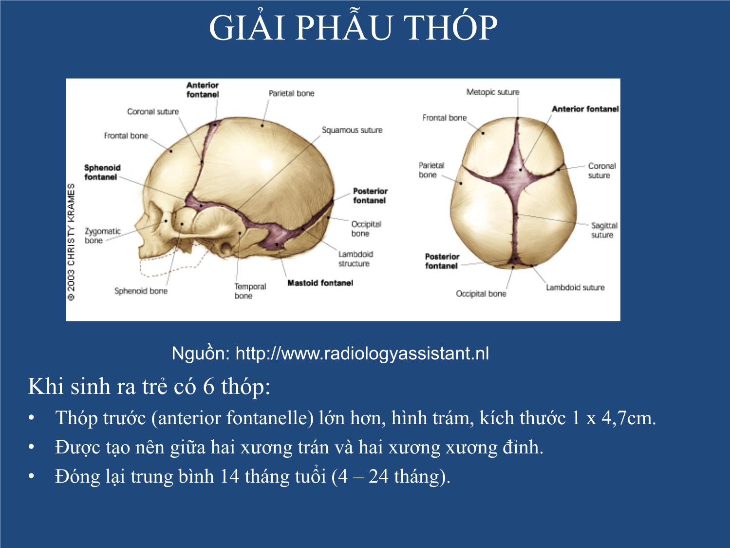 Bài giảng Neonatal Brain US trang 4