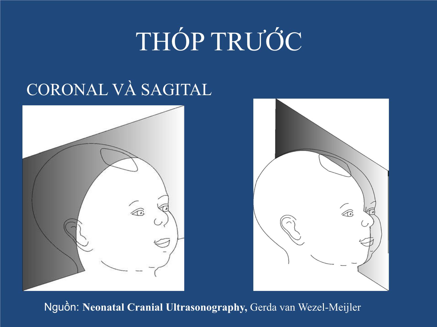 Bài giảng Neonatal Brain US trang 6