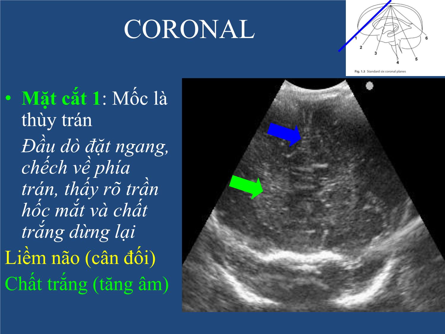 Bài giảng Neonatal Brain US trang 8