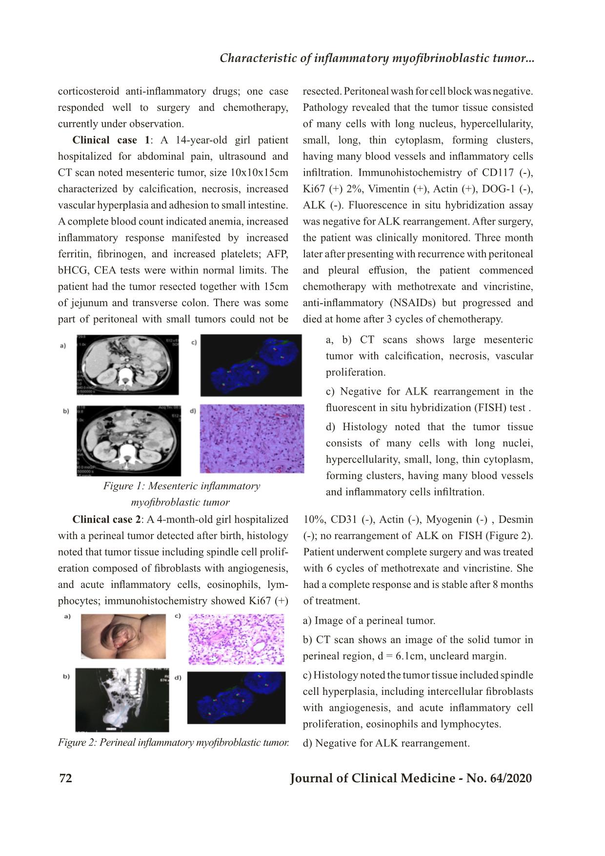 Characteristic of inflammatory myofibrinoblastic tumor: Retrospective analysis of 4 cases in children hospital number 2 trang 3