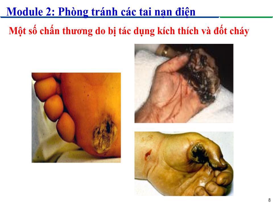 Module 2: Phòng tránh các tai nạn điện - Bài 1: Ảnh hưởng của dòng điện lên cơ thể người trang 8