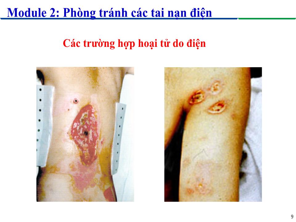 Module 2: Phòng tránh các tai nạn điện - Bài 1: Ảnh hưởng của dòng điện lên cơ thể người trang 9