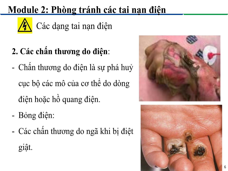 Bài giảng Module 2: Phòng tránh các tai nạn điện - Bài 3: Các dạng tai nạn điện trang 6