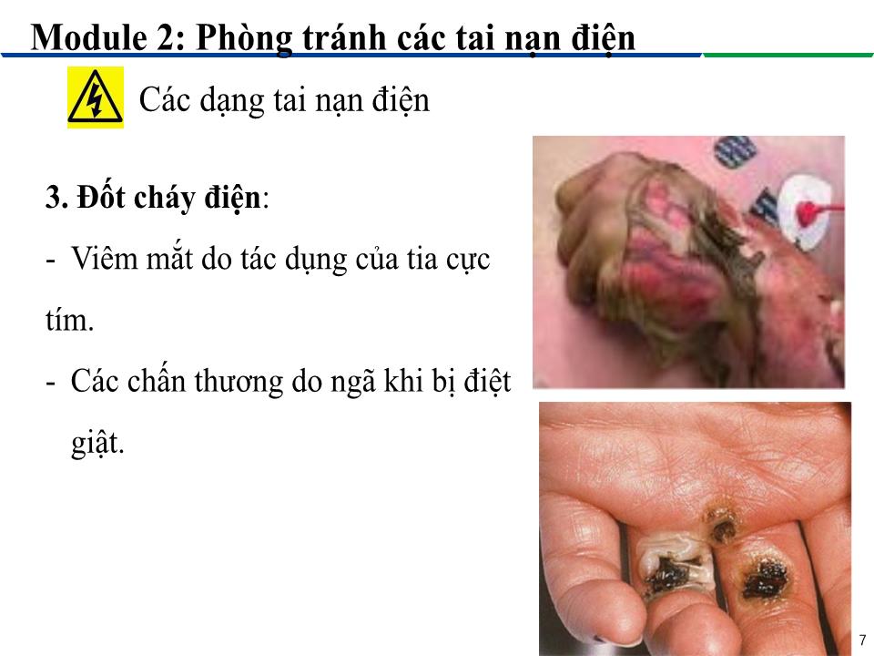 Bài giảng Module 2: Phòng tránh các tai nạn điện - Bài 3: Các dạng tai nạn điện trang 7