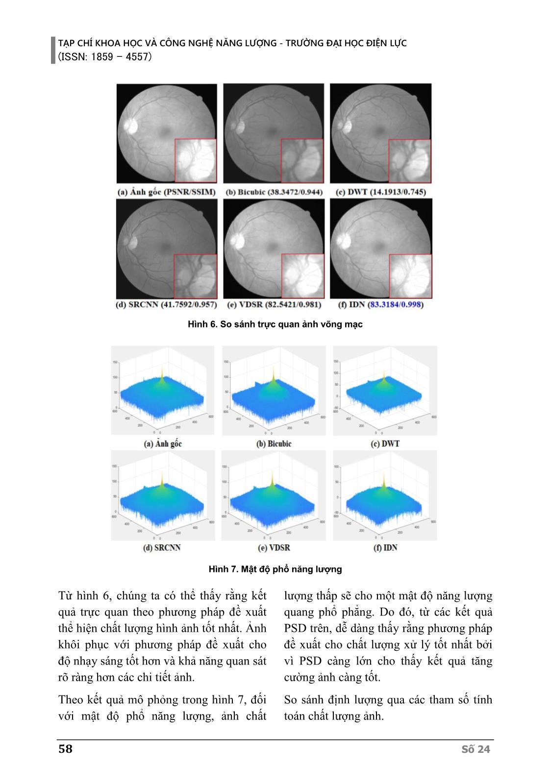 Siêu phân giải dùng trí tuệ nhân tạo nâng cao chất lượng ảnh võng mạc mắt người trang 9