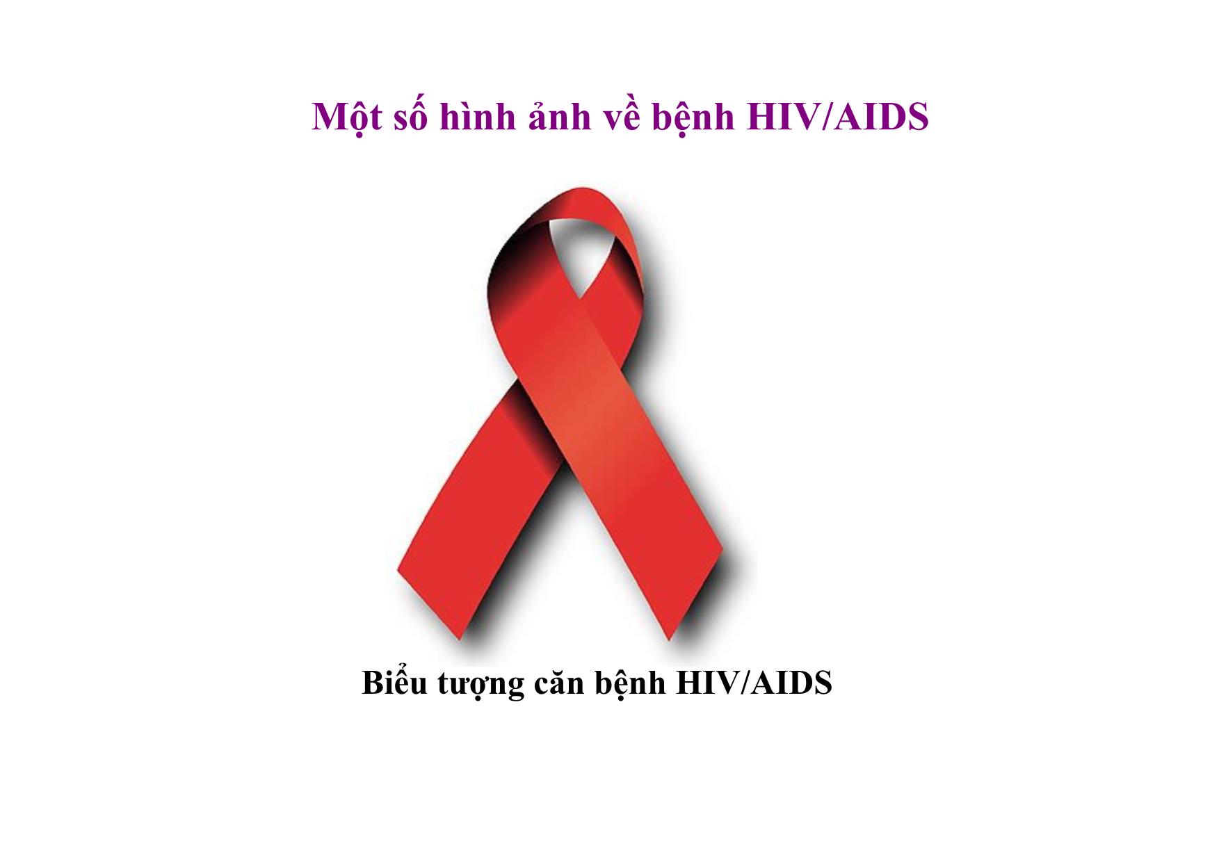 Bài giảng Ngữ văn Lớp 12 - Văn bản: Thông điệp nhân ngày thế giới phòng chống AIDS, 1- 12 - 2003 trang 6